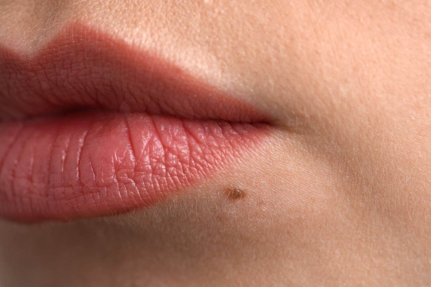 Blackheads around the lips