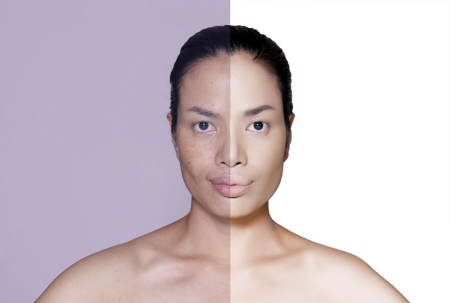 Transform acne-prone skin into clear, radiant skin.